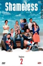 Shameless - Stagione 2 (3 Dvd)